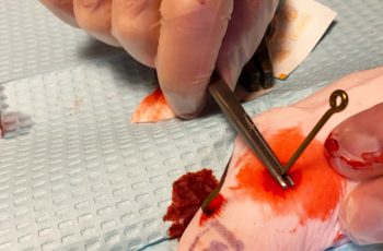 Marine medicine: Understanding and treating infection types